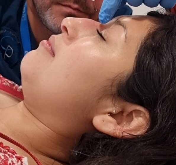 acido hialurónico